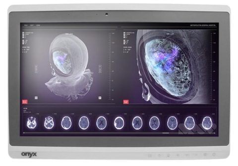 Onyx-Zeus-248 Professional Medical AIO i7-6500U/8GB/256GB SSD NEW *TouchScreen* *No Stand*